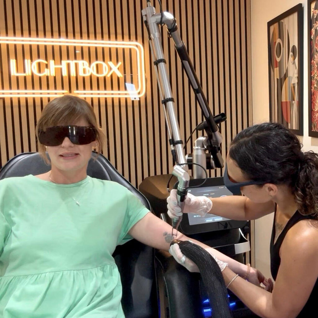 Practitioner performing laser tattoo removal on a client's forearm using picosecond laser technology